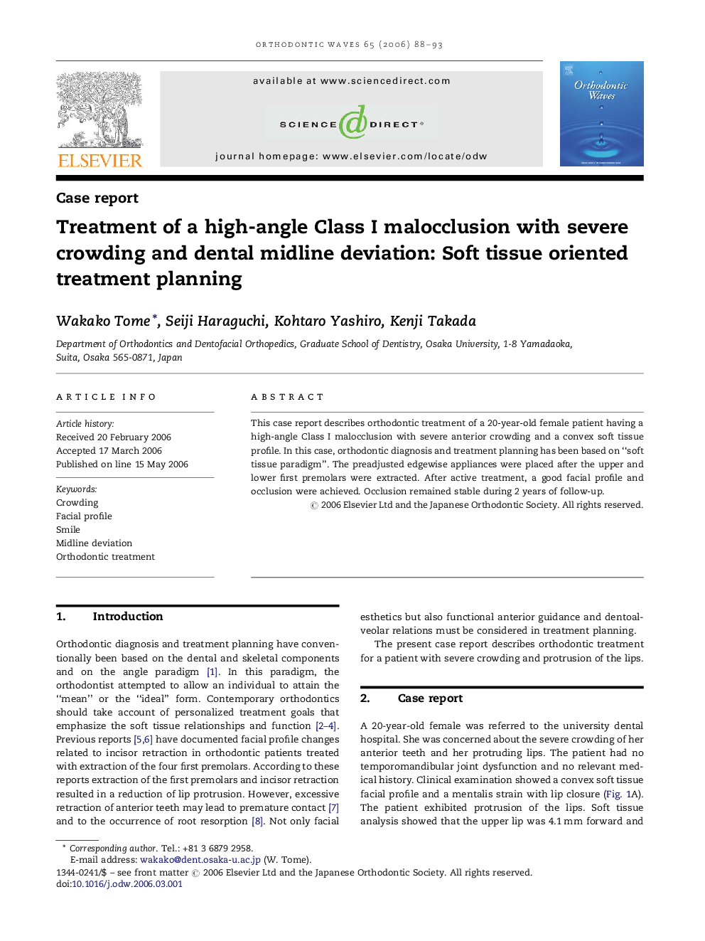 Treatment of a high-angle Class I malocclusion with severe crowding and dental midline deviation: Soft tissue oriented treatment planning