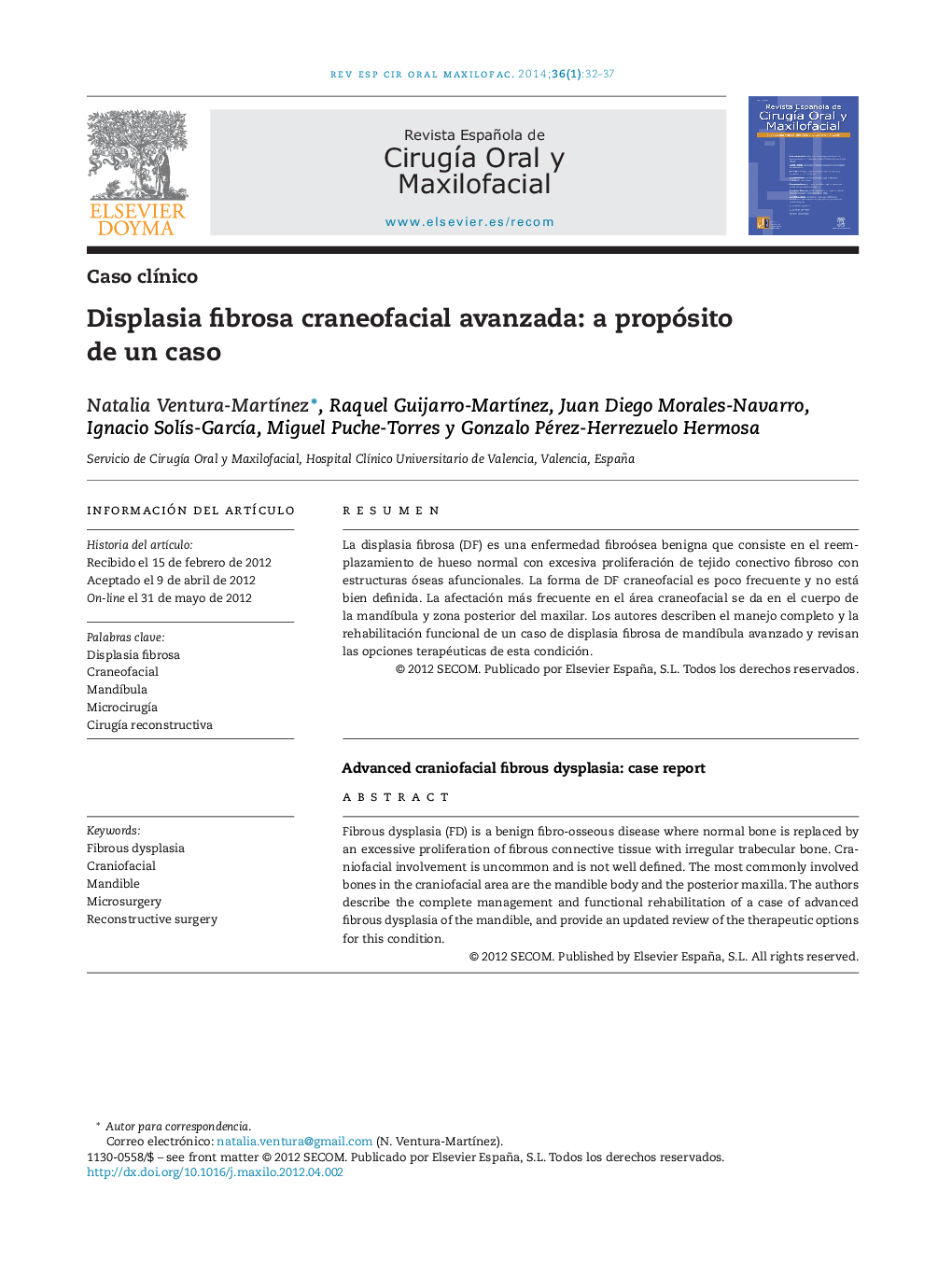 Displasia fibrosa craneofacial avanzada: a propósito de un caso