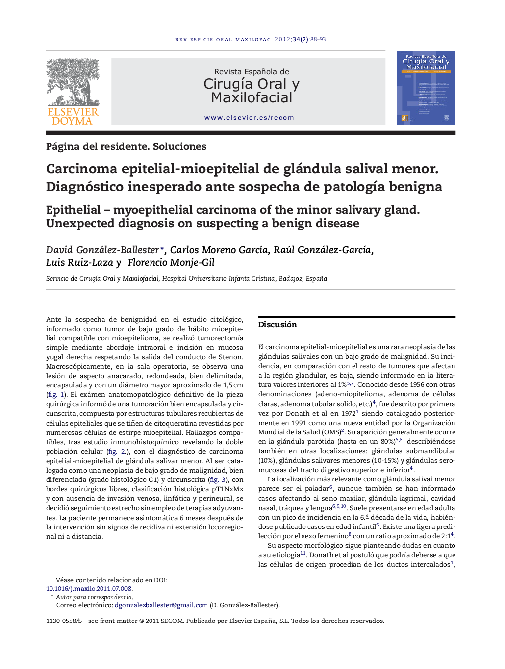 Carcinoma epitelial-mioepitelial de glándula salival menor. Diagnóstico inesperado ante sospecha de patologÃ­a benigna