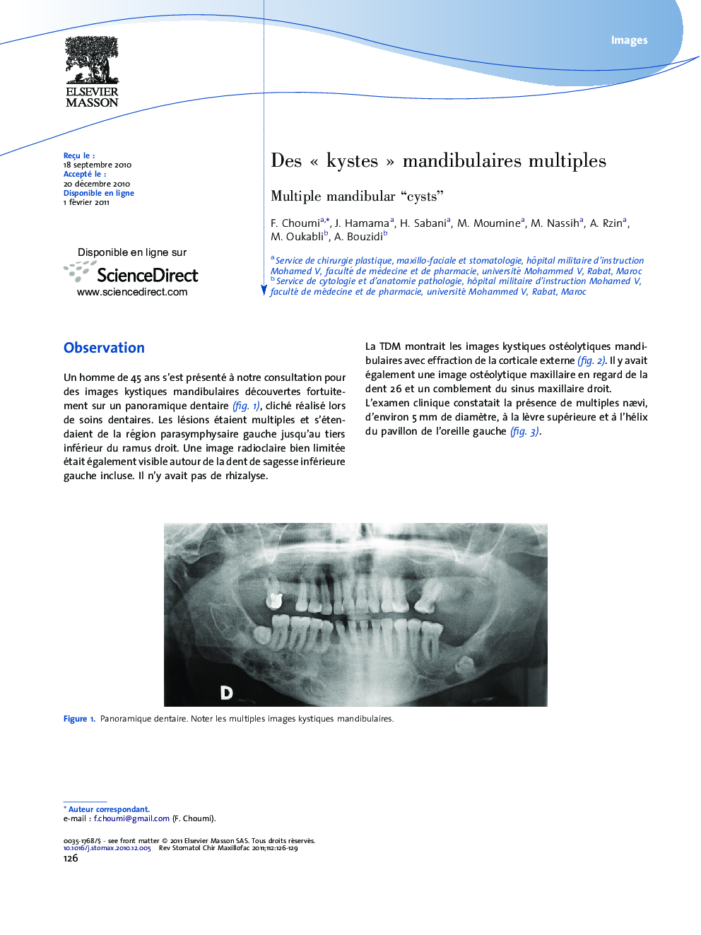 Des Â«Â kystesÂ Â» mandibulaires multiples