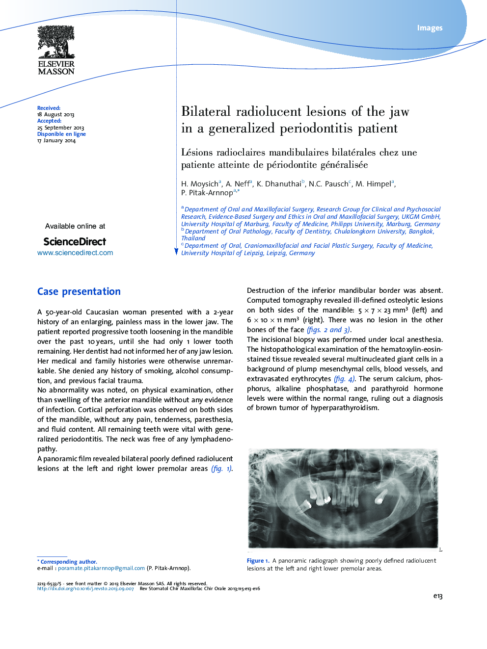 Bilateral radiolucent lesions of the jaw in a generalized periodontitis patient