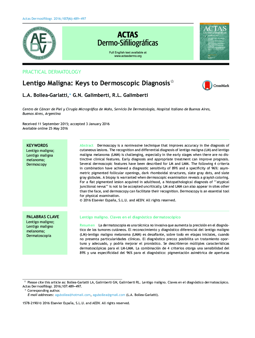 Lentigo Maligna: Keys to Dermoscopic Diagnosis 