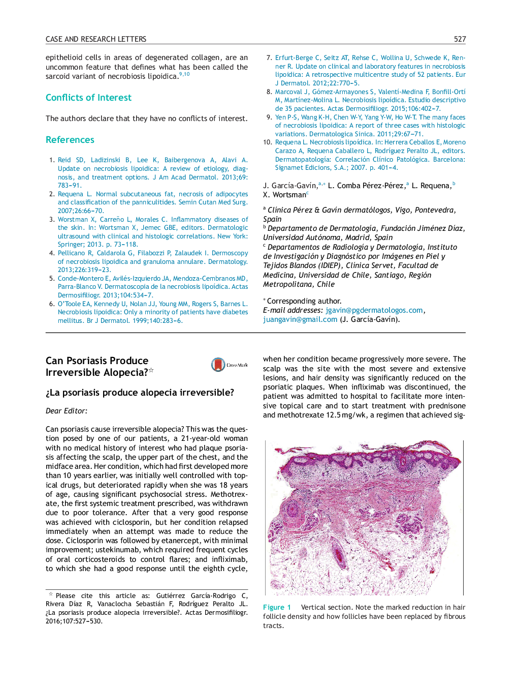 Can Psoriasis Produce Irreversible Alopecia?