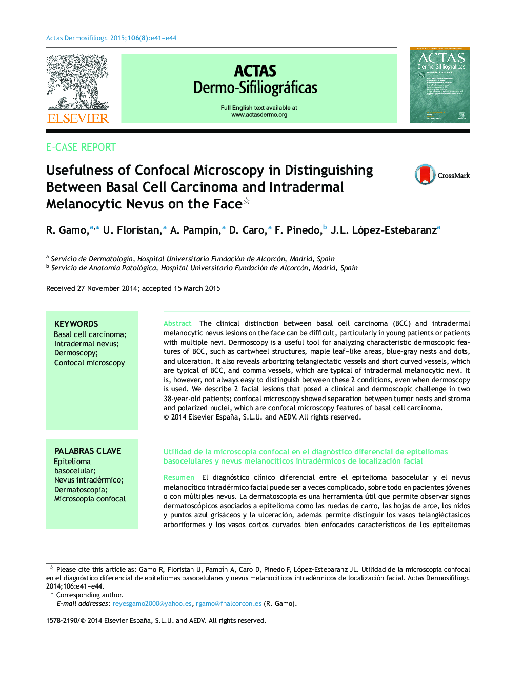 Usefulness of Confocal Microscopy in Distinguishing Between Basal Cell Carcinoma and Intradermal Melanocytic Nevus on the Face 