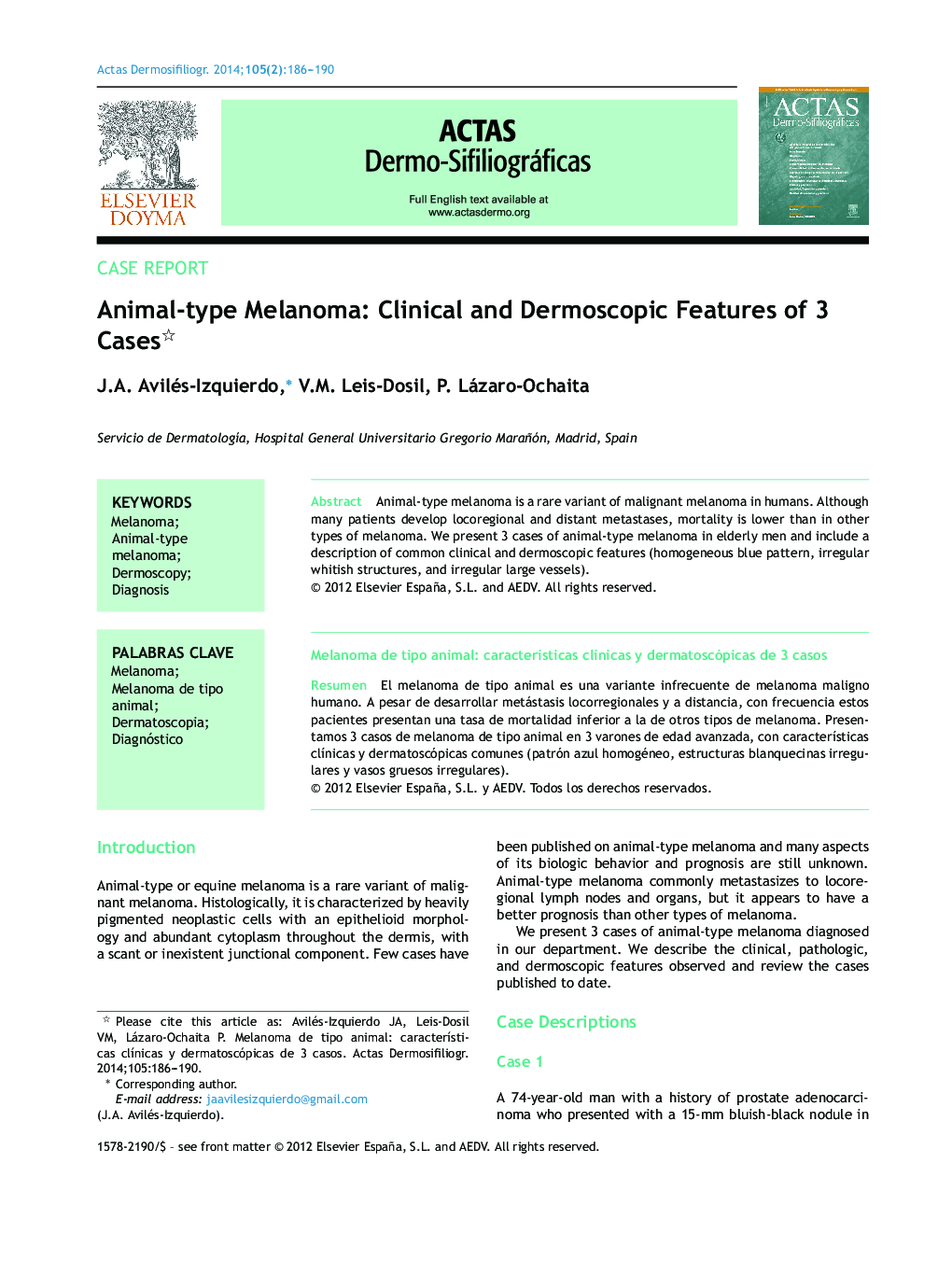 Animal-type Melanoma: Clinical and Dermoscopic Features of 3 Cases 