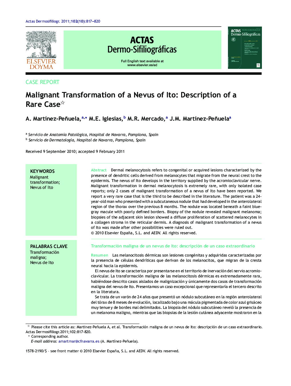 Malignant Transformation of a Nevus of Ito: Description of a Rare Case 