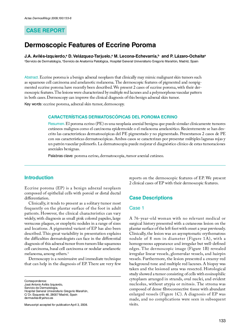 Dermoscopic Features of Eccrine Poroma