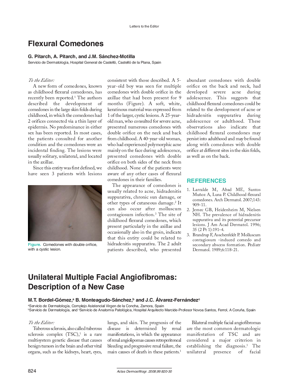 Unilateral Multiple Facial Angiofibromas: Description of a New Case