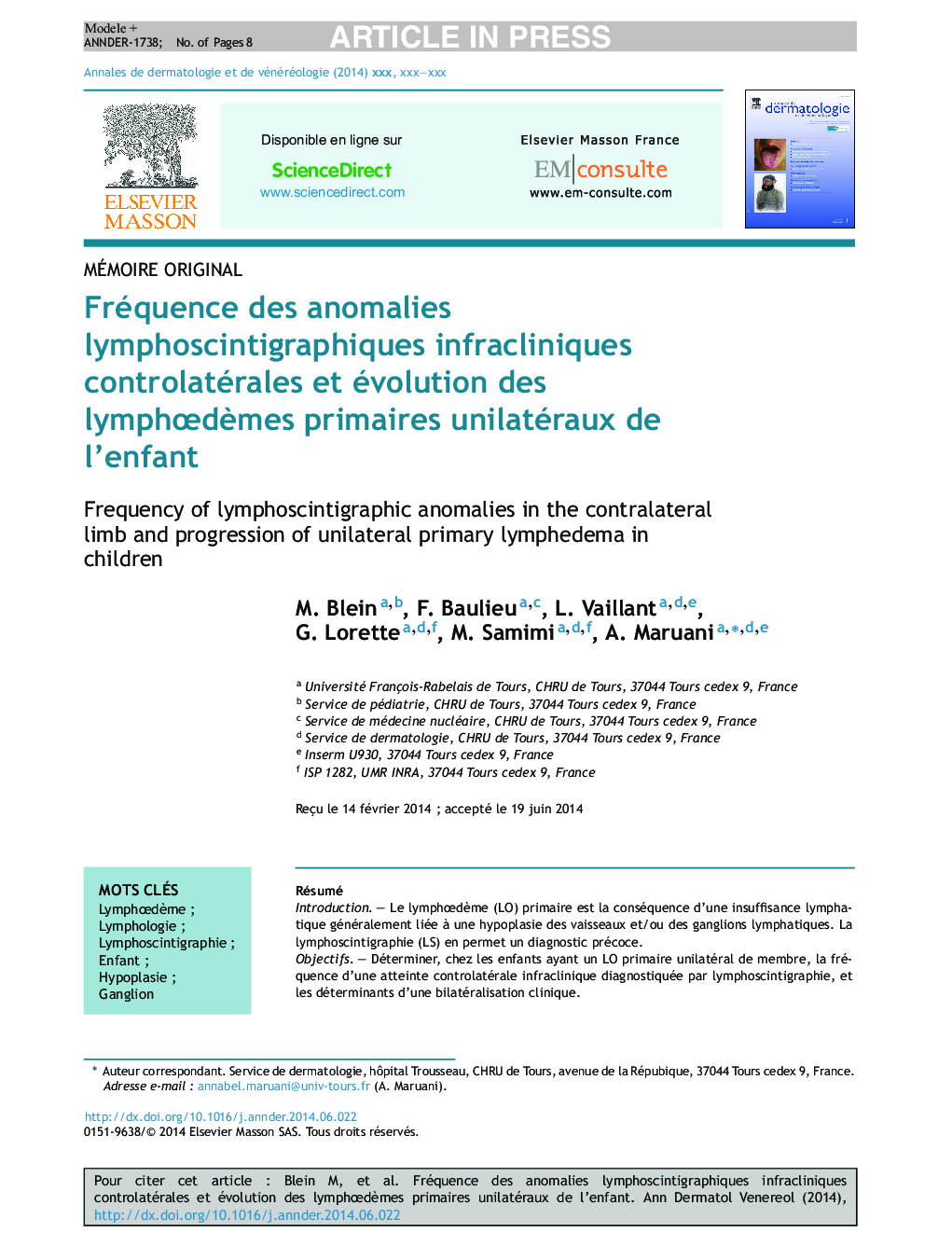 Fréquence des anomalies lymphoscintigraphiques infracliniques controlatérales et évolution des lymphÅdÃ¨mes primaires unilatéraux de l'enfant