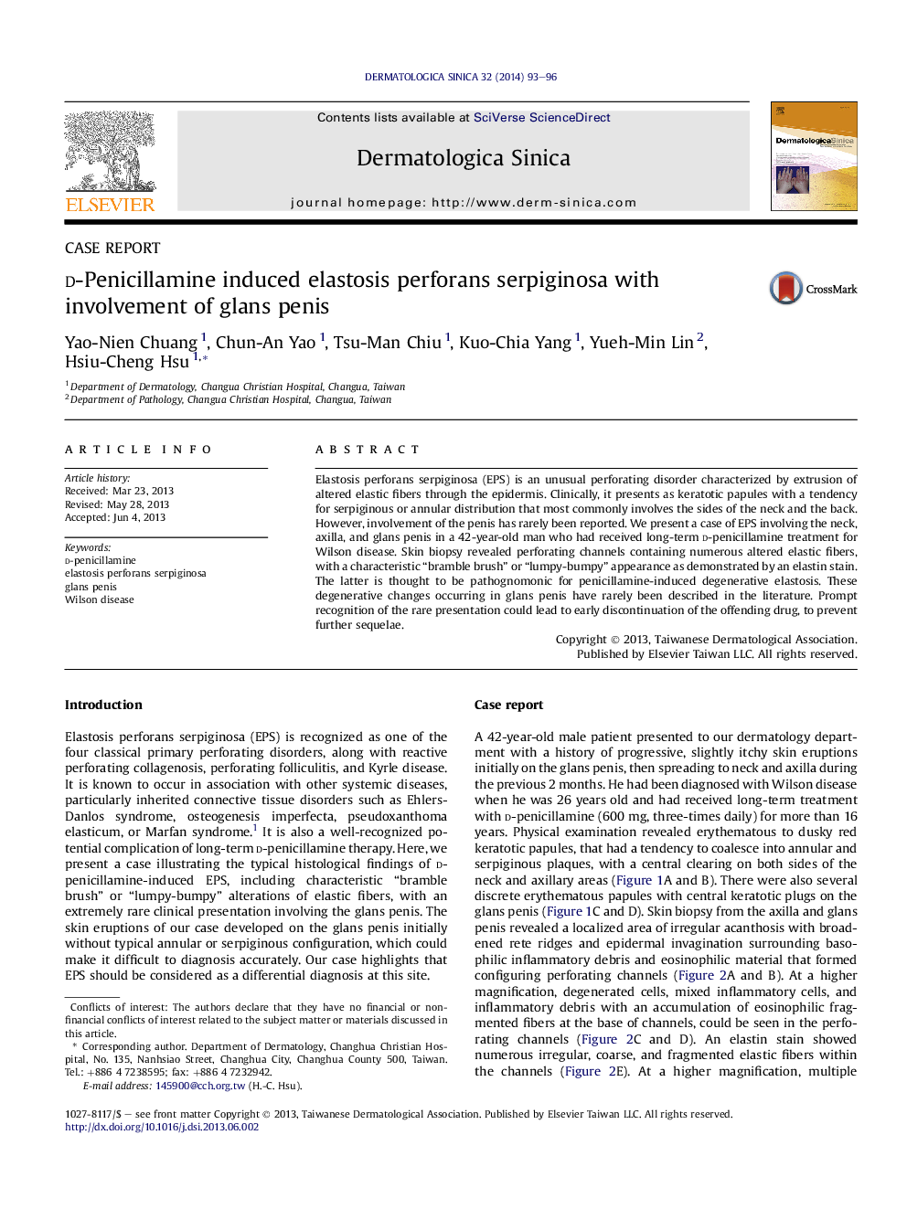 d-Penicillamine induced elastosis perforans serpiginosa with involvement of glans penis 