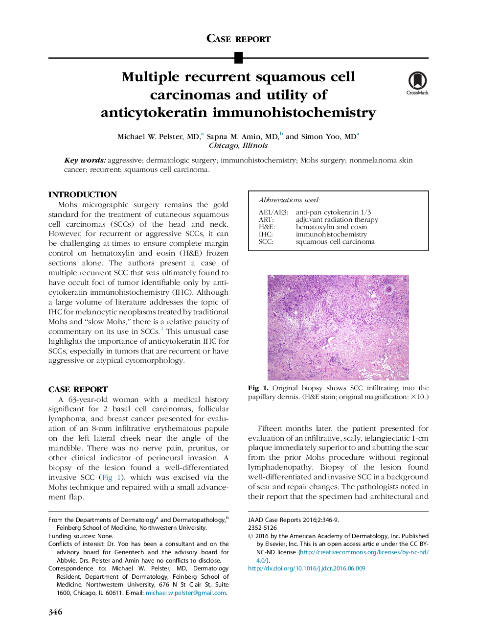 Multiple recurrent squamous cell carcinomas and utility of anticytokeratin immunohistochemistry