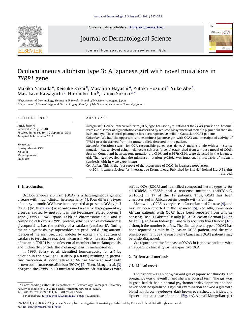 Oculocutaneous albinism type 3: A Japanese girl with novel mutations in TYRP1 gene