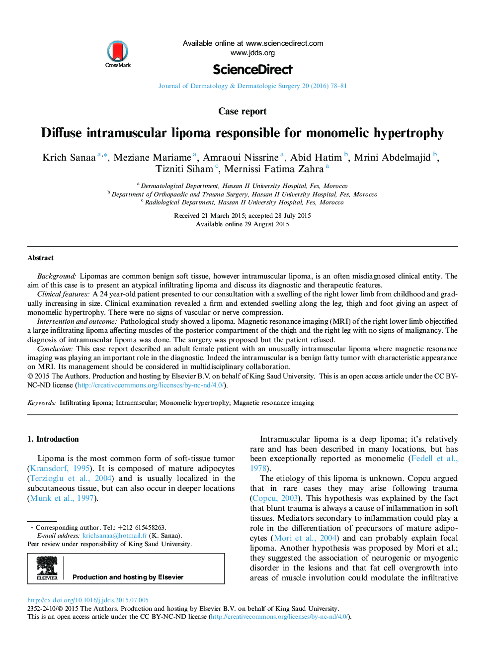 Diffuse intramuscular lipoma responsible for monomelic hypertrophy 