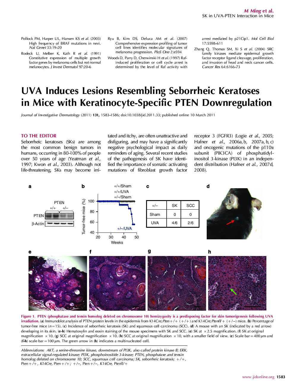 UVA Induces Lesions Resembling Seborrheic Keratoses in Mice with Keratinocyte-Specific PTEN Downregulation