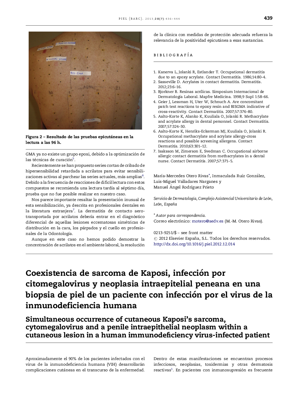 Coexistencia de sarcoma de Kaposi, infección por citomegalovirus y neoplasia intraepitelial peneana en una biopsia de piel de un paciente con infección por el virus de la inmunodeficiencia humana
