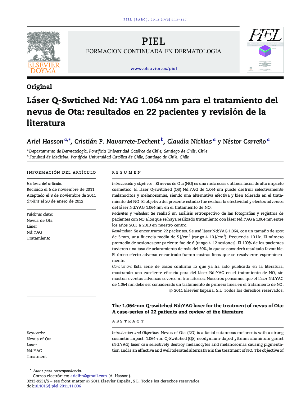 Láser Q-Swtiched Nd: YAG 1.064 nm para el tratamiento del nevus de Ota: resultados en 22 pacientes y revisión de la literatura