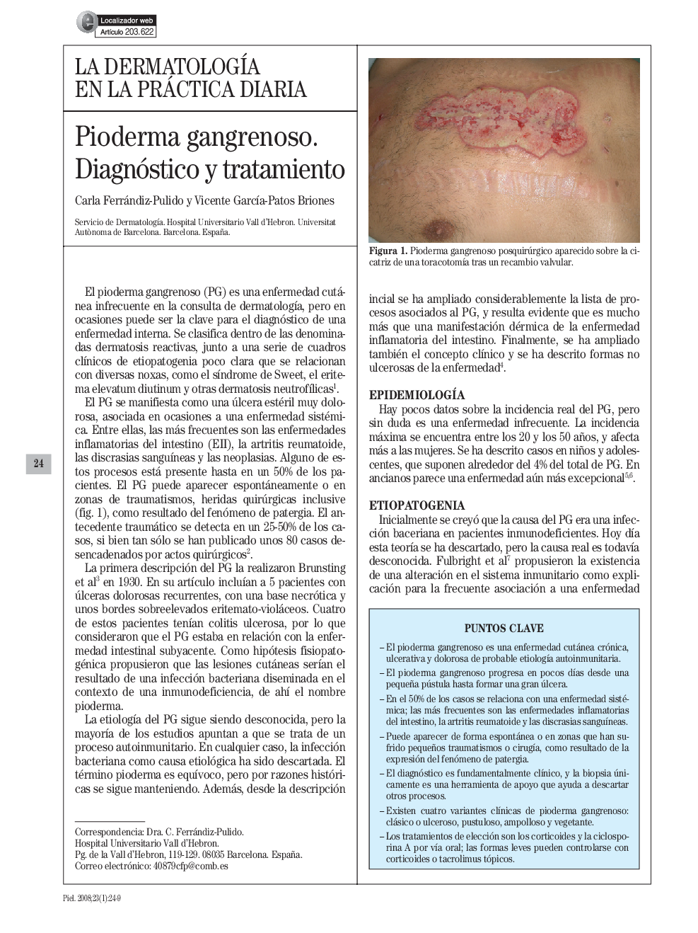 Pioderma gangrenoso. Diagnóstico y tratamiento