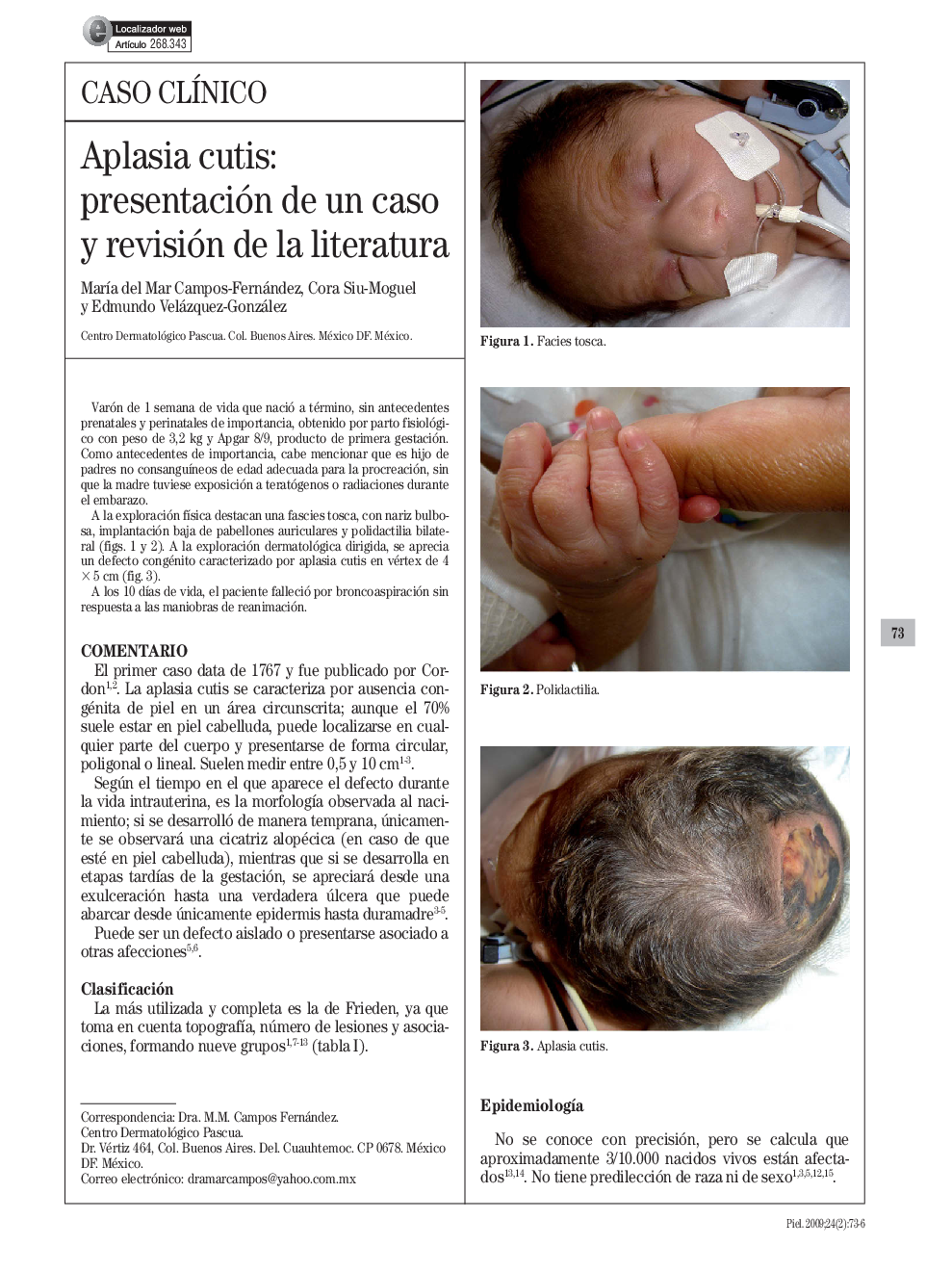 Aplasia cutis: presentación de un caso y revisión de la literatura