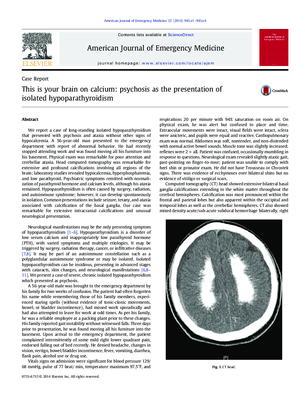 This is your brain on calcium: psychosis as the presentation of isolated hypoparathyroidism