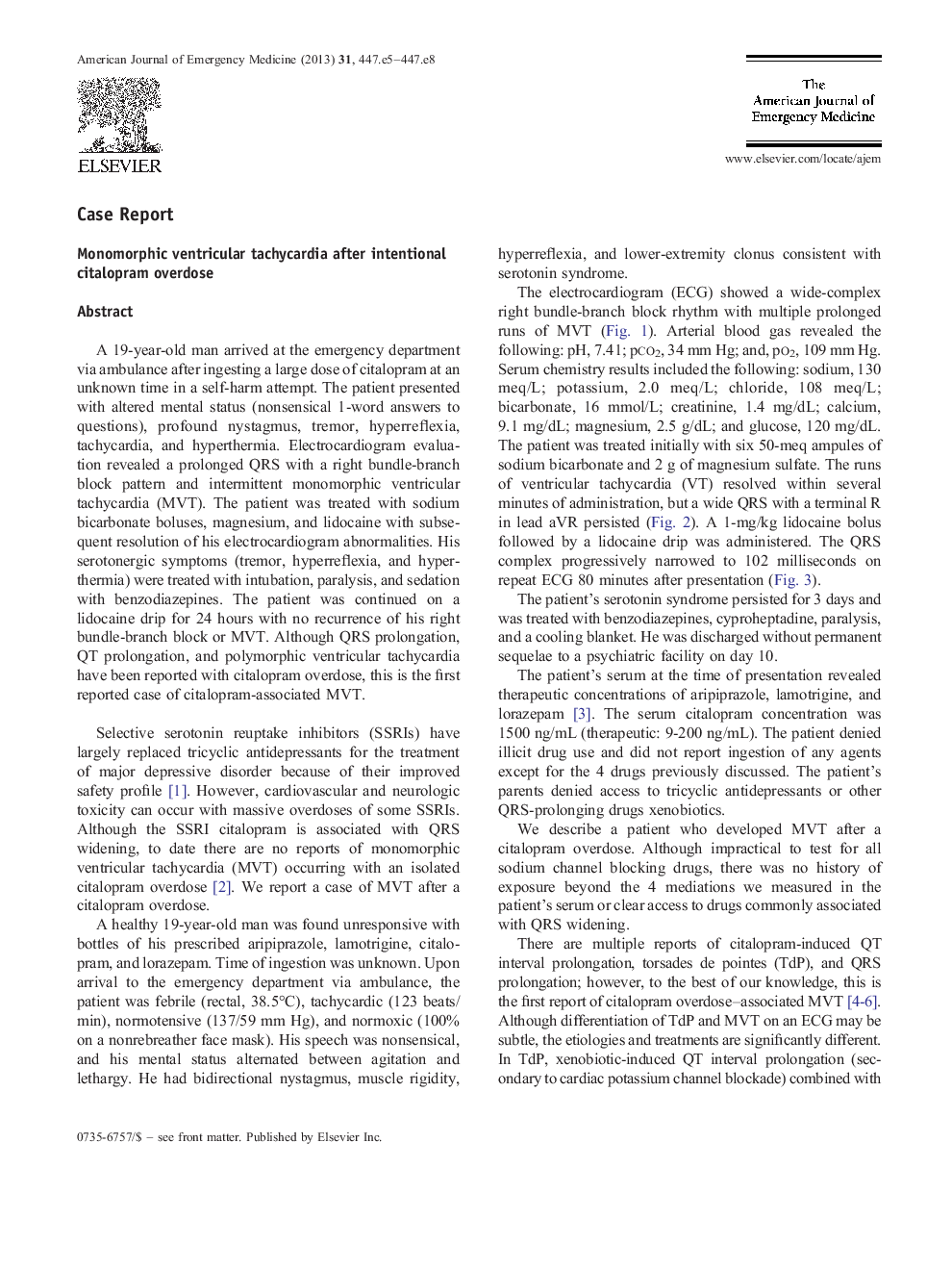 Monomorphic ventricular tachycardia after intentional citalopram overdose