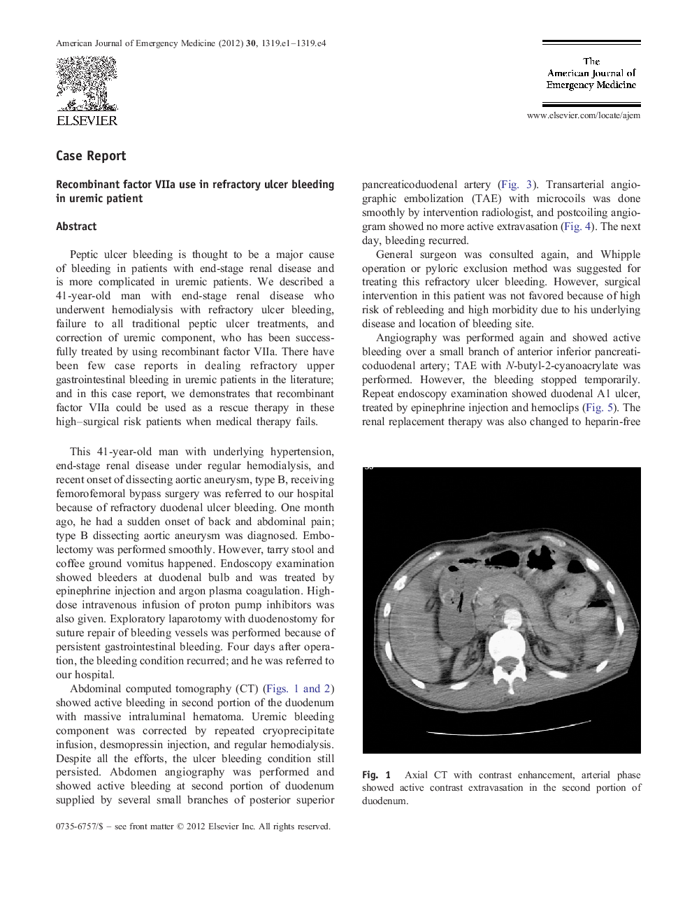 Recombinant factor VIIa use in refractory ulcer bleeding in uremic patient
