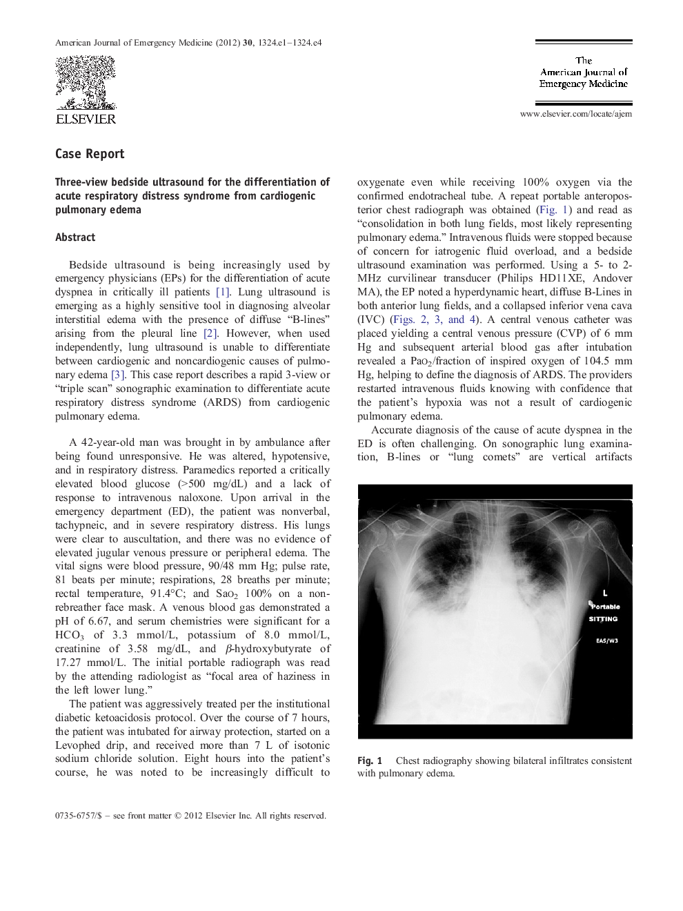 Three-view bedside ultrasound for the differentiation of acute respiratory distress syndrome from cardiogenic pulmonary edema