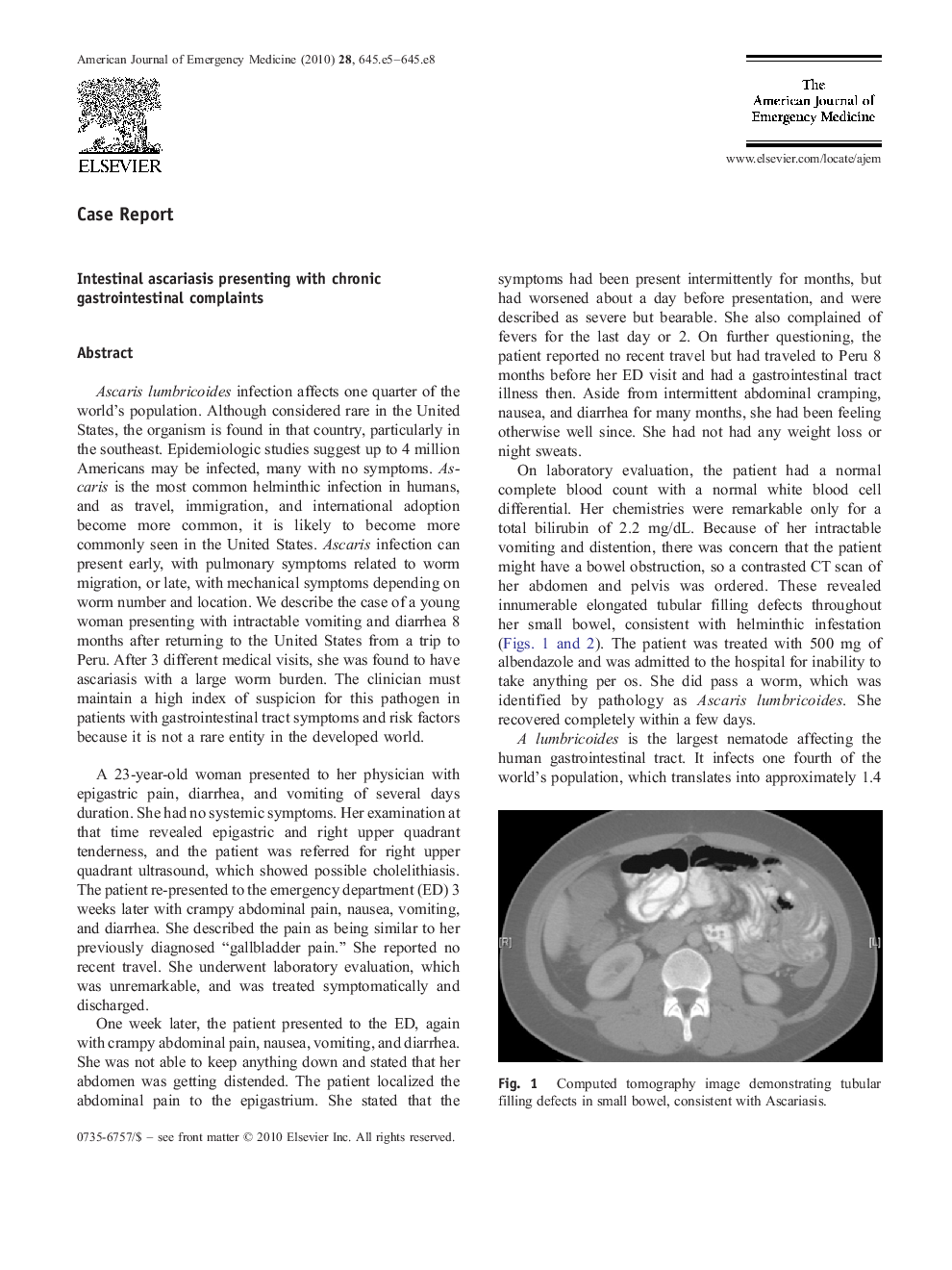 Intestinal ascariasis presenting with chronic gastrointestinal complaints
