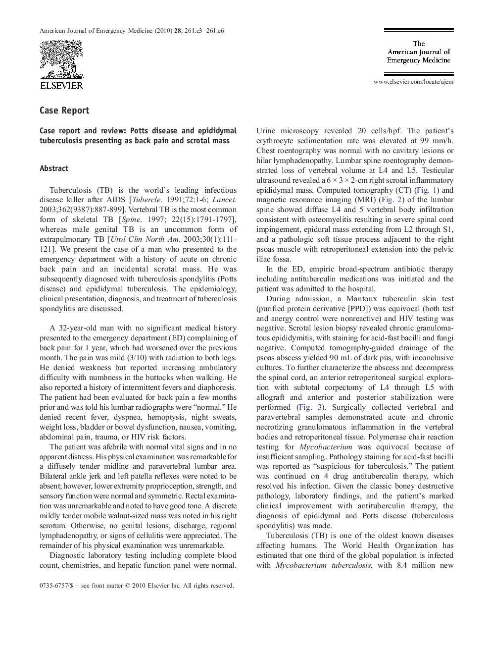 Case report and review: Potts disease and epididymal tuberculosis presenting as back pain and scrotal mass