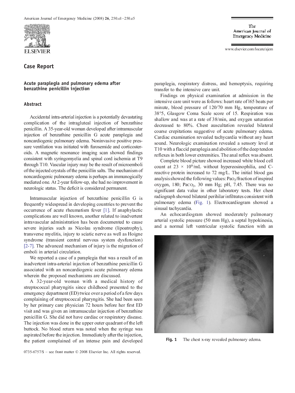 Acute paraplegia and pulmonary edema after benzathine penicillin injection
