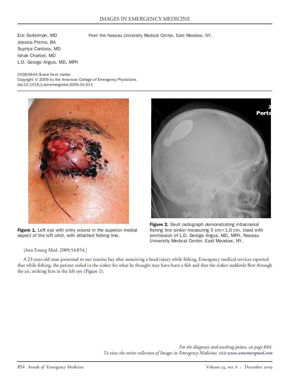 Young Man With Fishing Injury