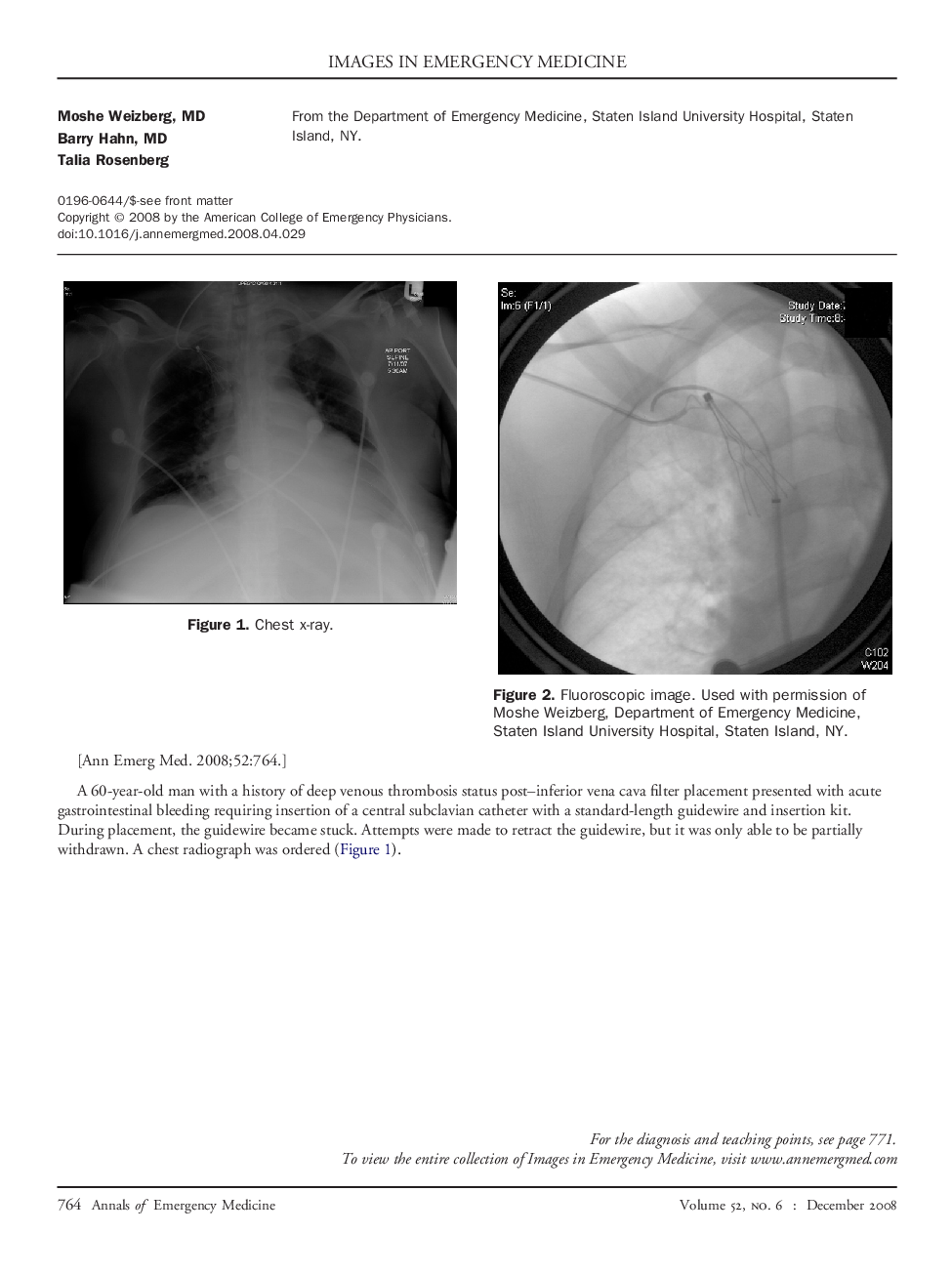 Man With Acute Gastrointestinal Bleed