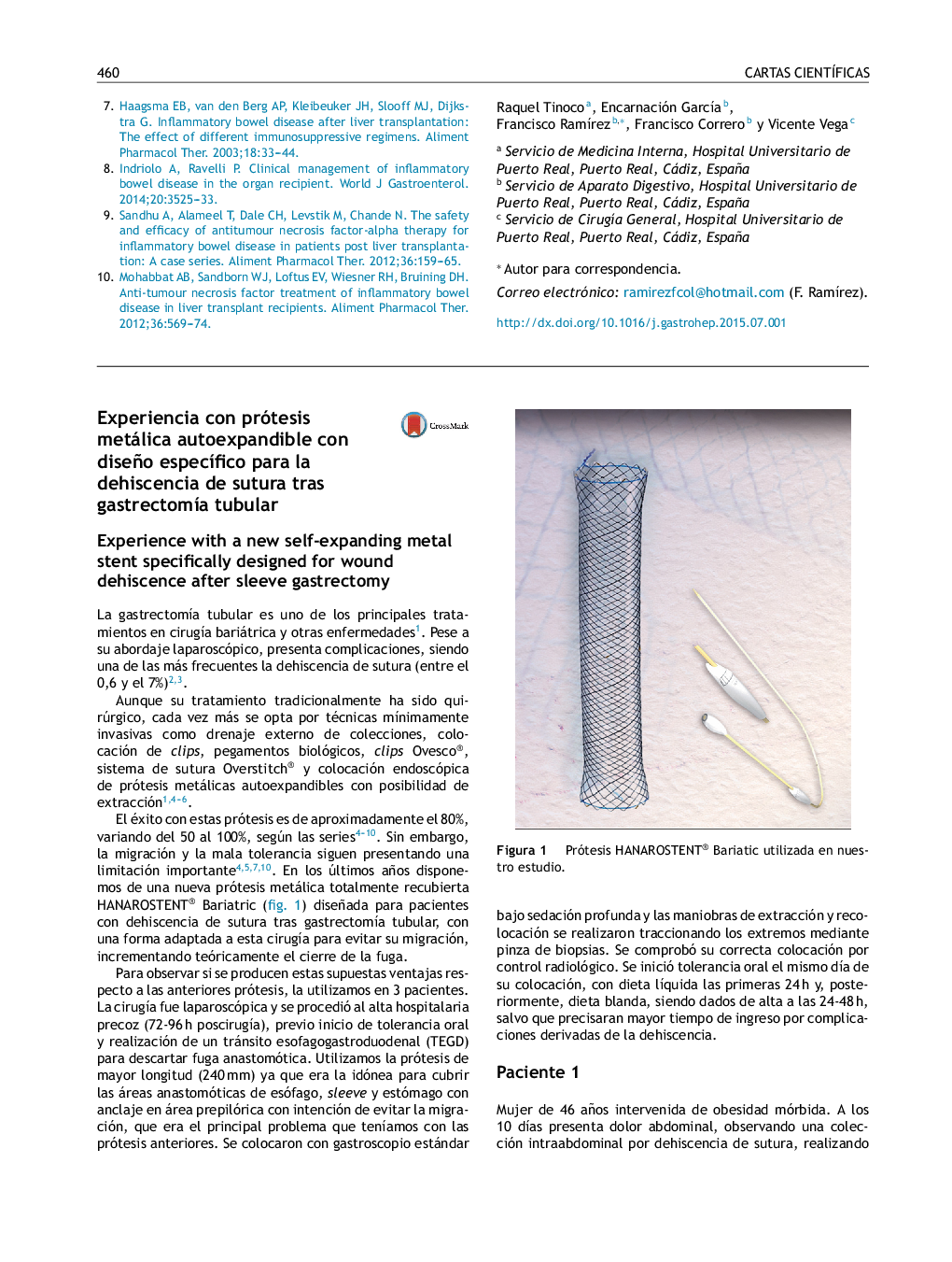 Experiencia con prótesis metálica autoexpandible con diseño especÃ­fico para la dehiscencia de sutura tras gastrectomÃ­a tubular