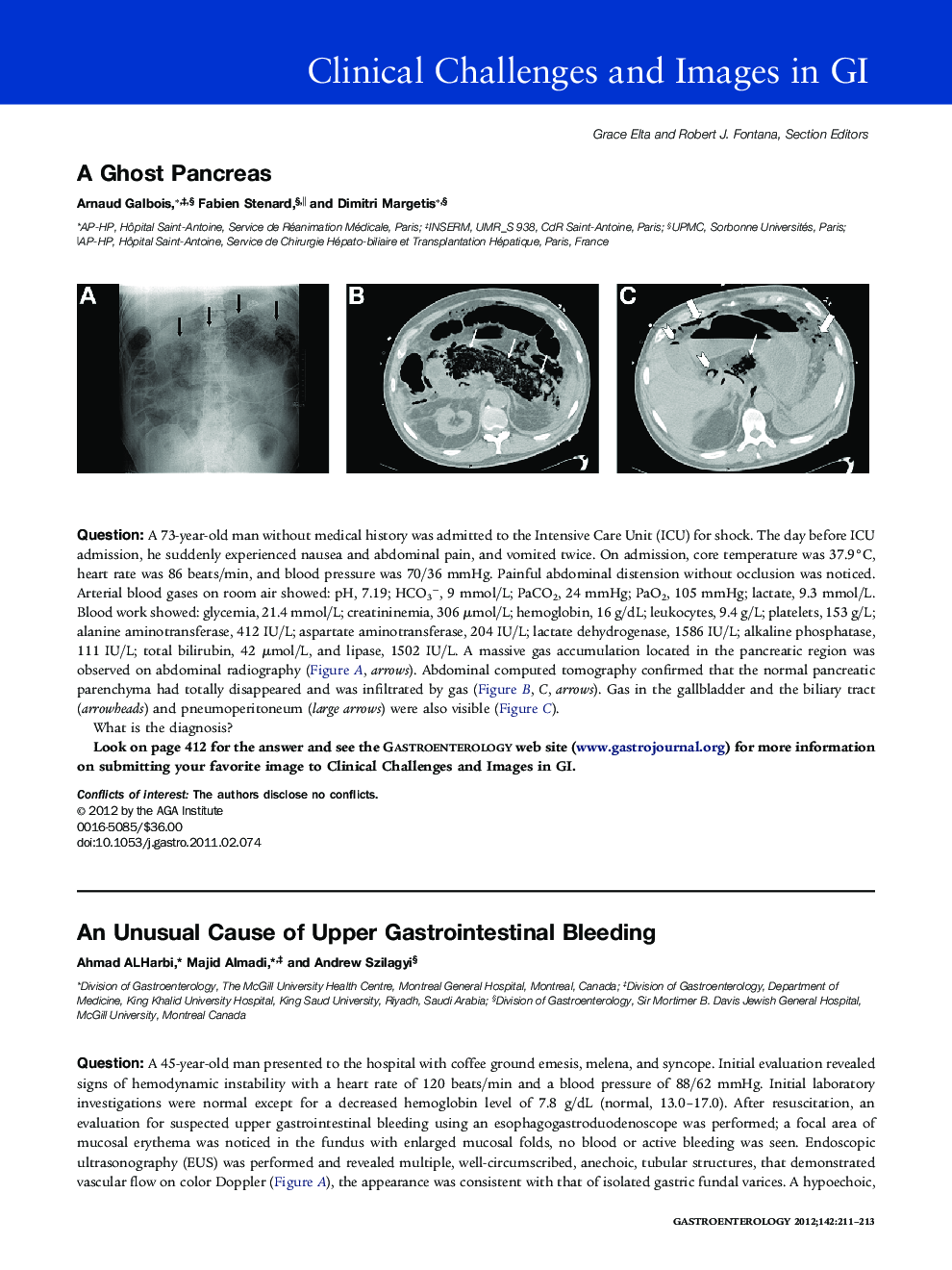 عکس صفحه اول مقاله: An Unusual Cause of Upper Gastrointestinal Bleeding An Unusual Cause of Upper Gastrointestinal Bleeding