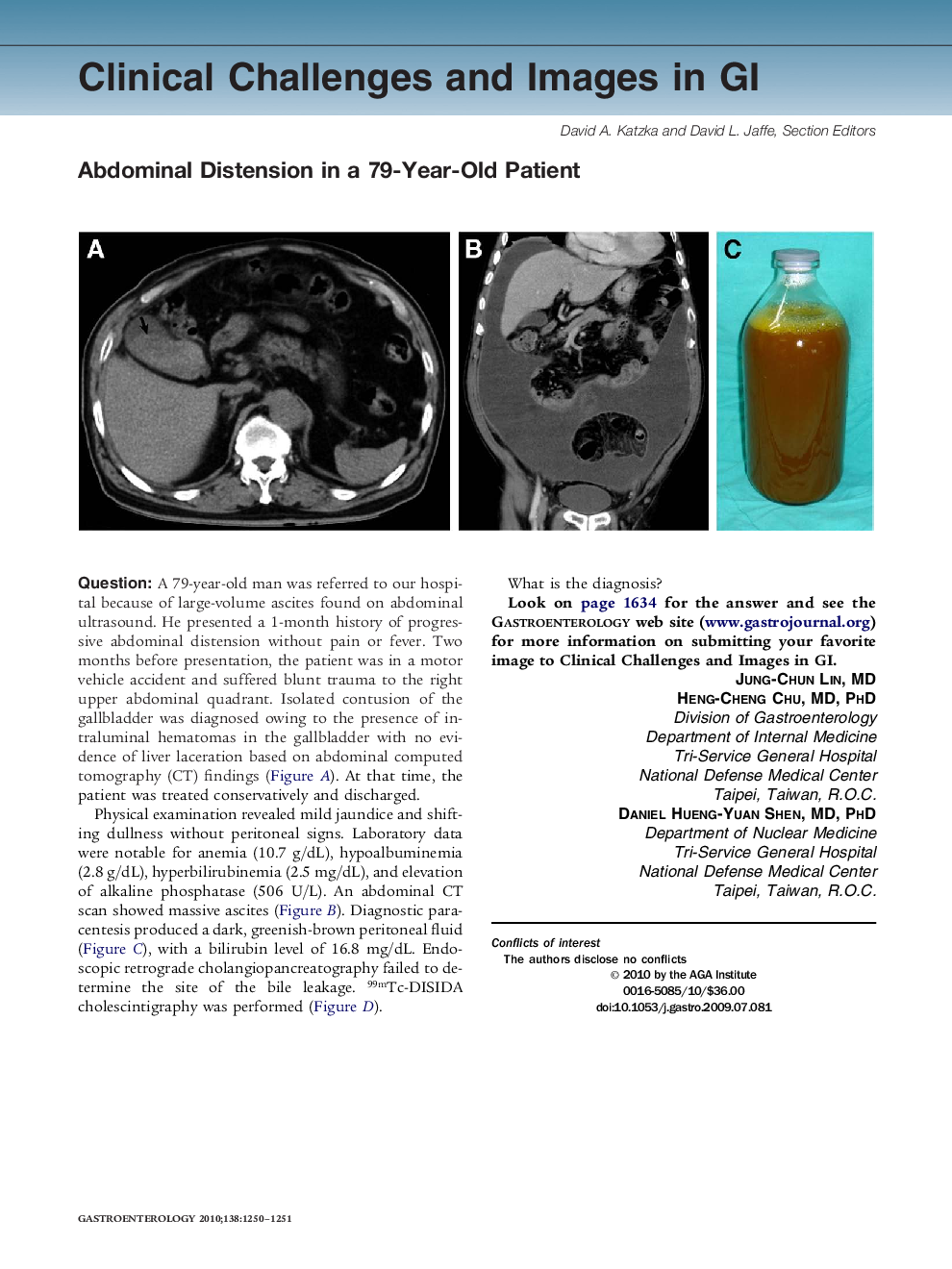 Abdominal Distension in a 79-Year-Old Patient