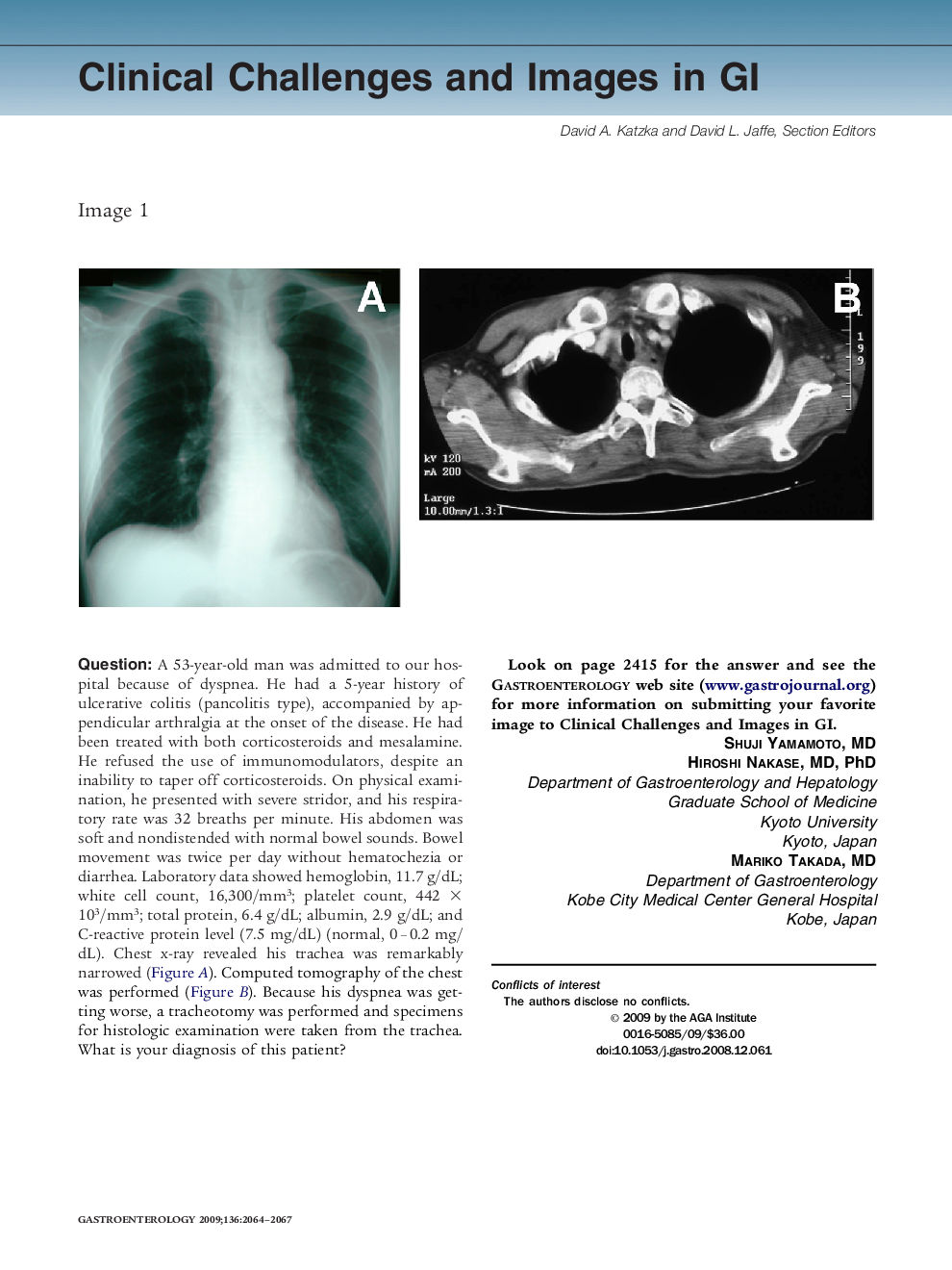 عکس صفحه اول مقاله: Clinical Challenges and Images in GI Clinical Challenges and Images in GI