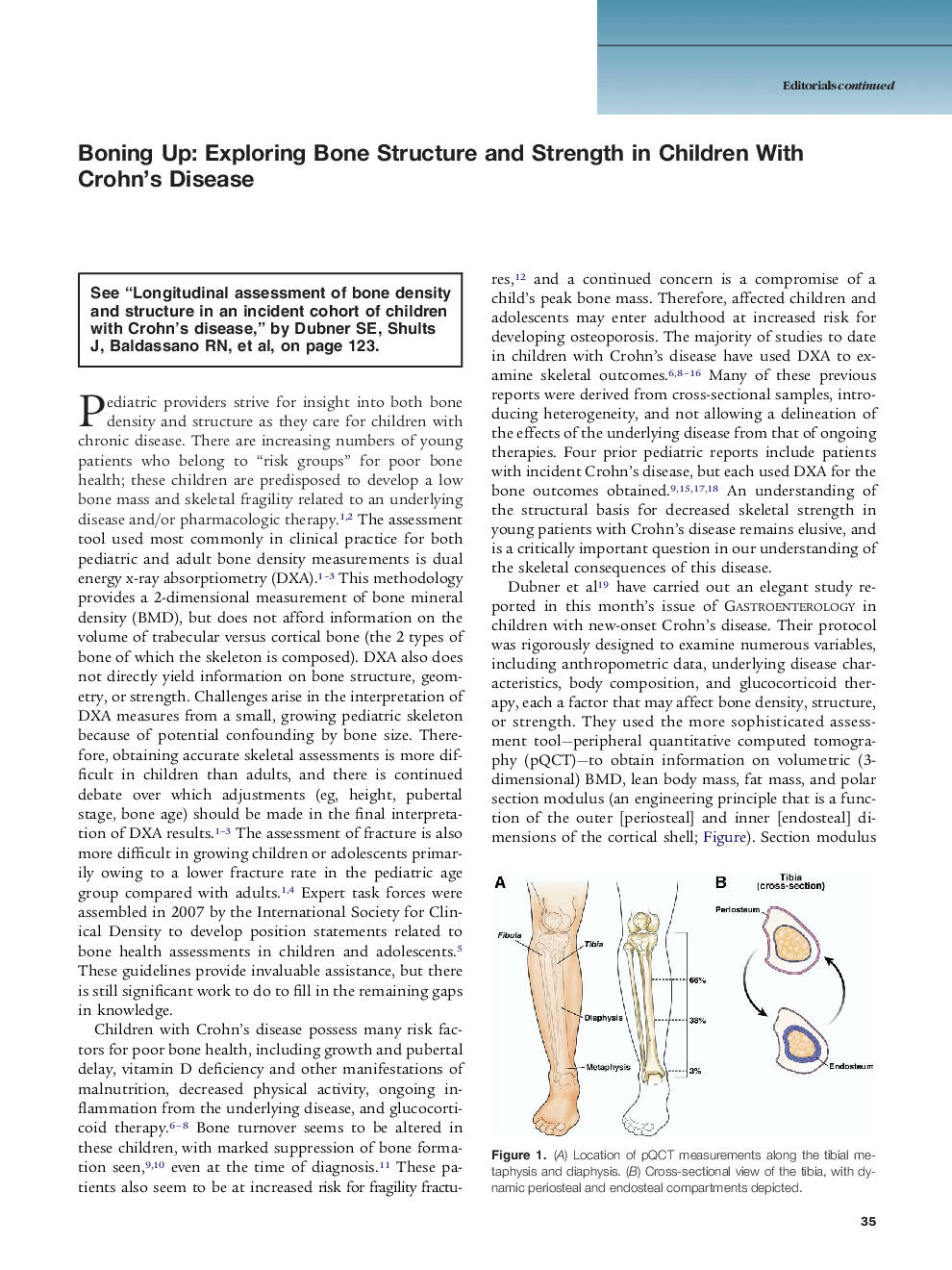 Boning Up: Exploring Bone Structure and Strength in Children With Crohn's Disease