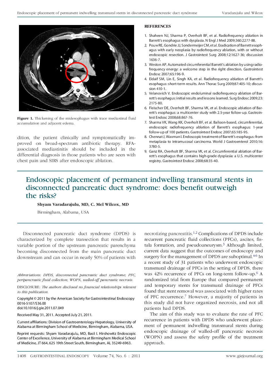 Endoscopic placement of permanent indwelling transmural stents in disconnected pancreatic duct syndrome: does benefit outweigh the risks?