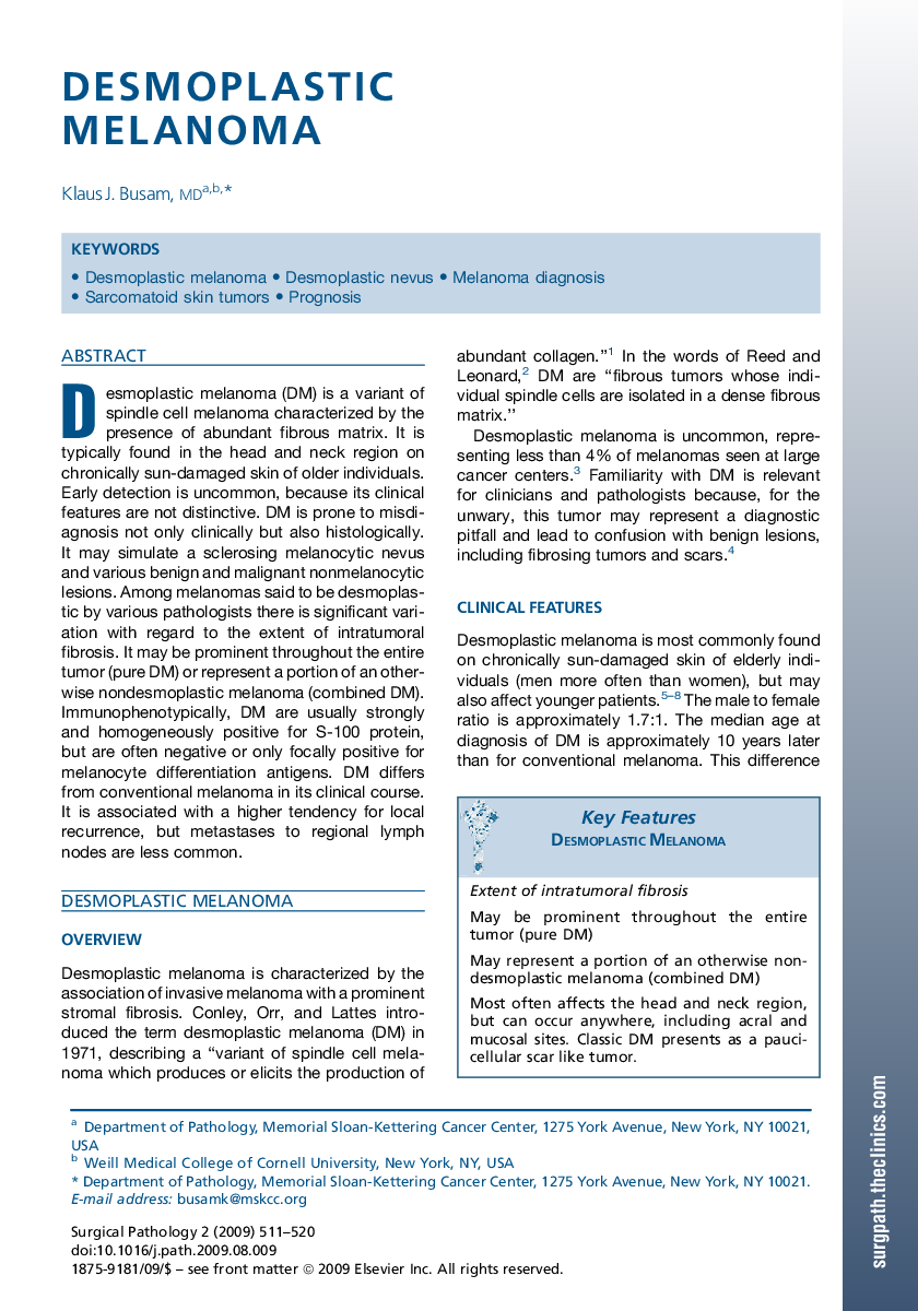 Desmoplastic Melanoma