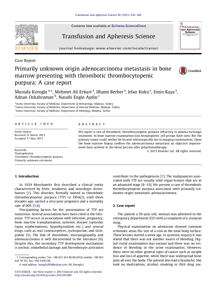 Primarily unknown origin adenocarcinoma metastasis in bone marrow presenting with thrombotic thrombocytopenic purpura: A case report