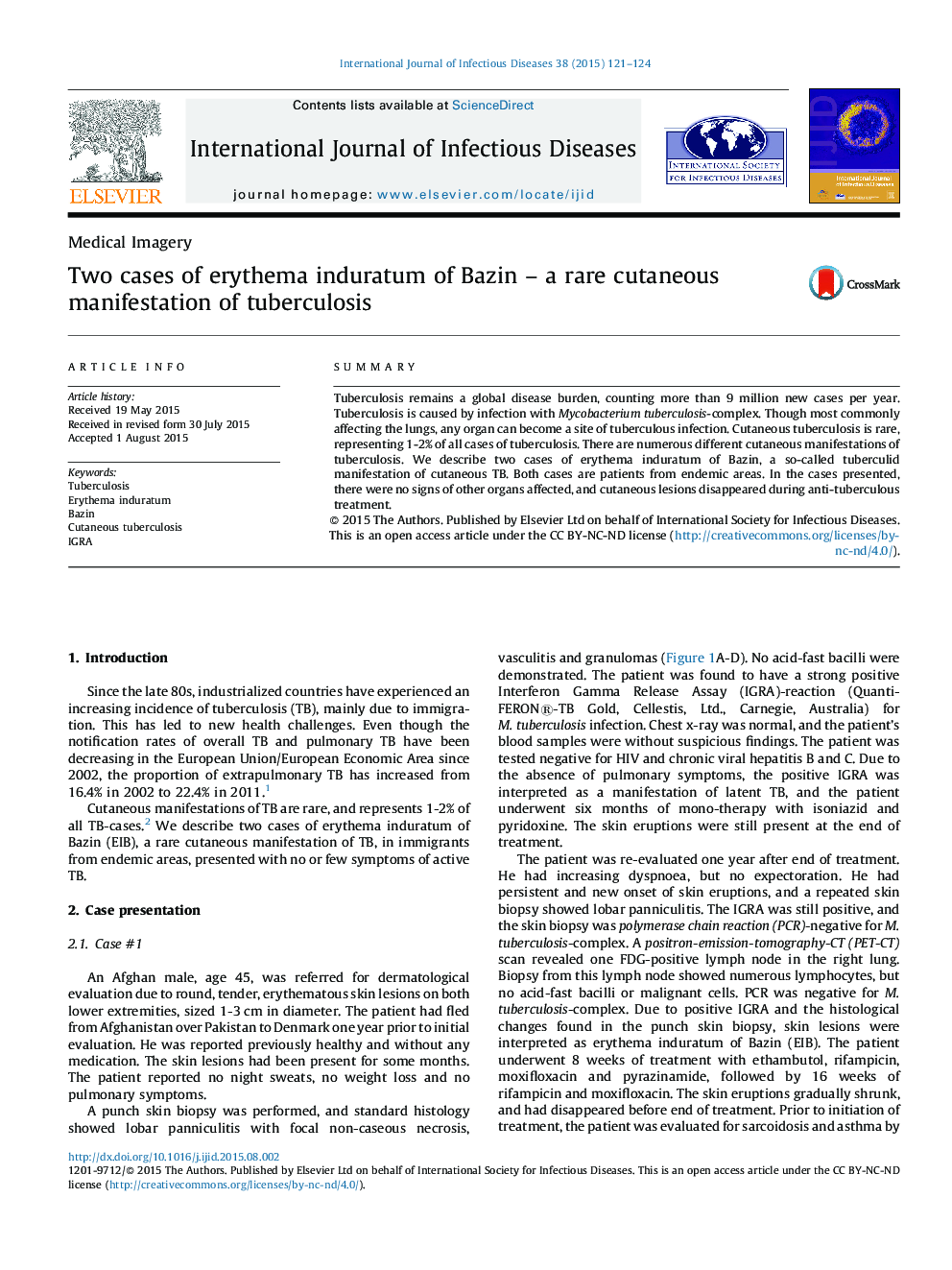 Two cases of erythema induratum of Bazin – a rare cutaneous manifestation of tuberculosis