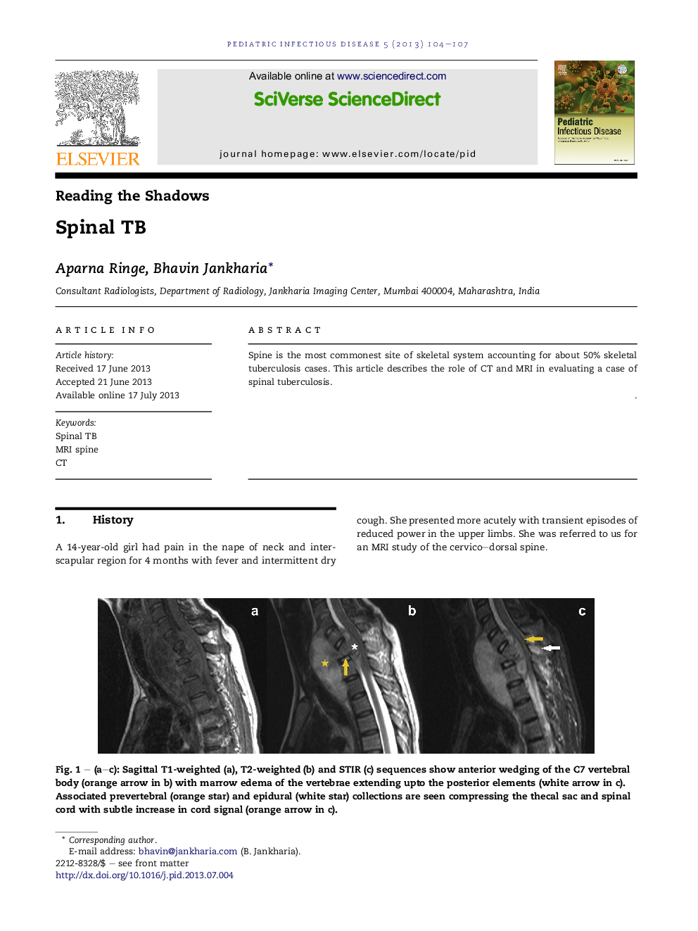 Spinal TB