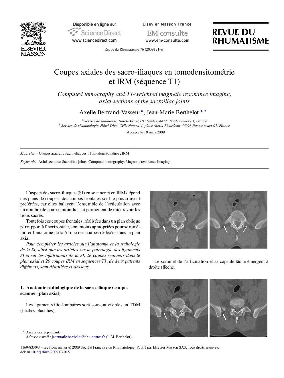 Coupes axiales des sacro-iliaques en tomodensitométrie et IRM (séquence T1)