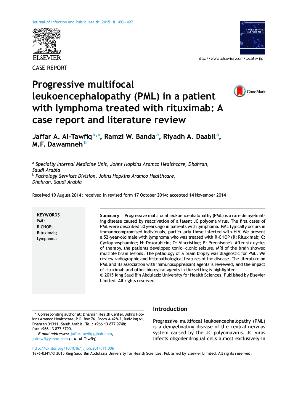 Progressive multifocal leukoencephalopathy (PML) in a patient with lymphoma treated with rituximab: A case report and literature review