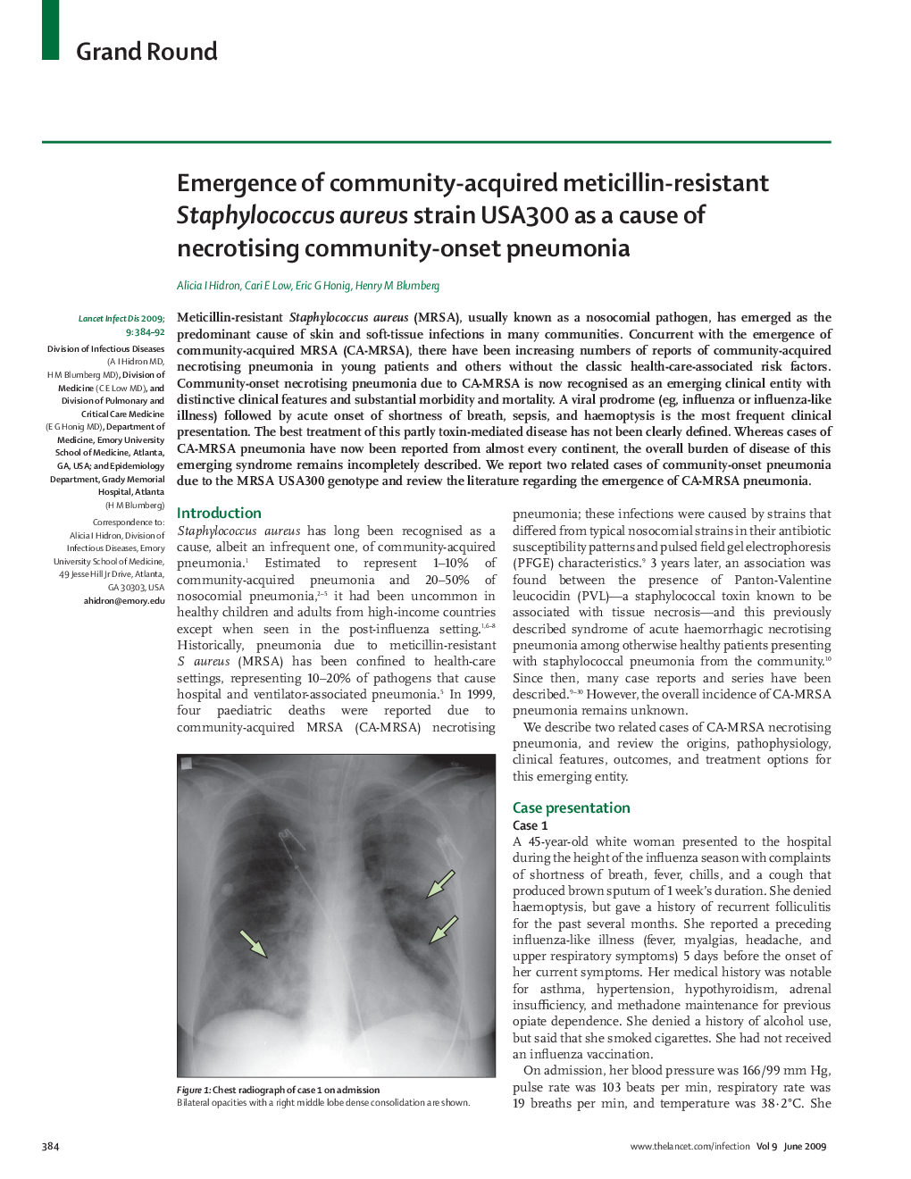 عکس صفحه اول مقاله: Emergence of community-acquired meticillin-resistant Staphylococcus aureus strain USA300 as a cause of necrotising community-onset pneumonia Emergence of community-acquired meticillin-resistant Staphylococcus aureus strain USA300 as a cause of necrotising community-onset pneumonia