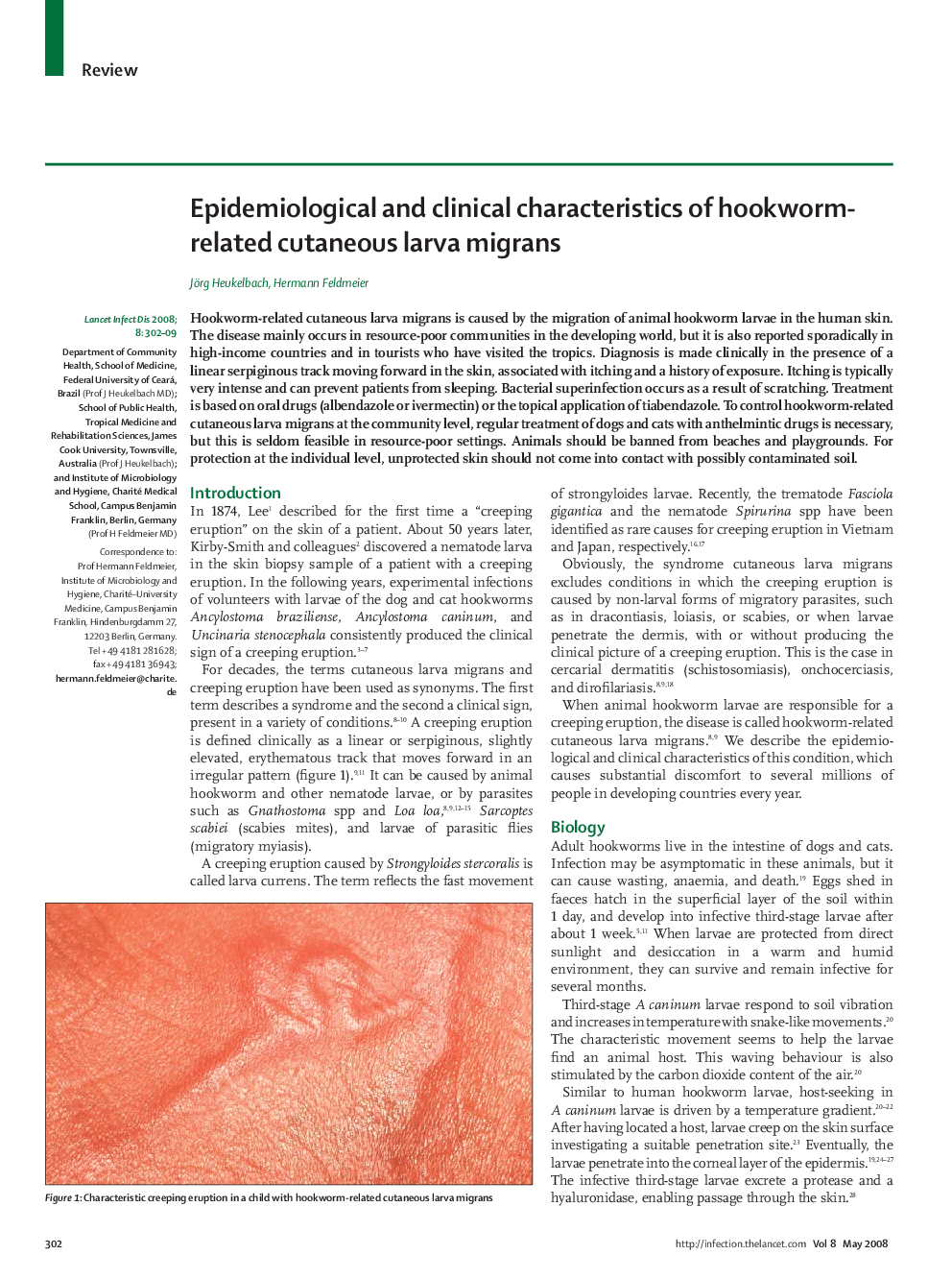 Epidemiological and clinical characteristics of hookworm-related cutaneous larva migrans