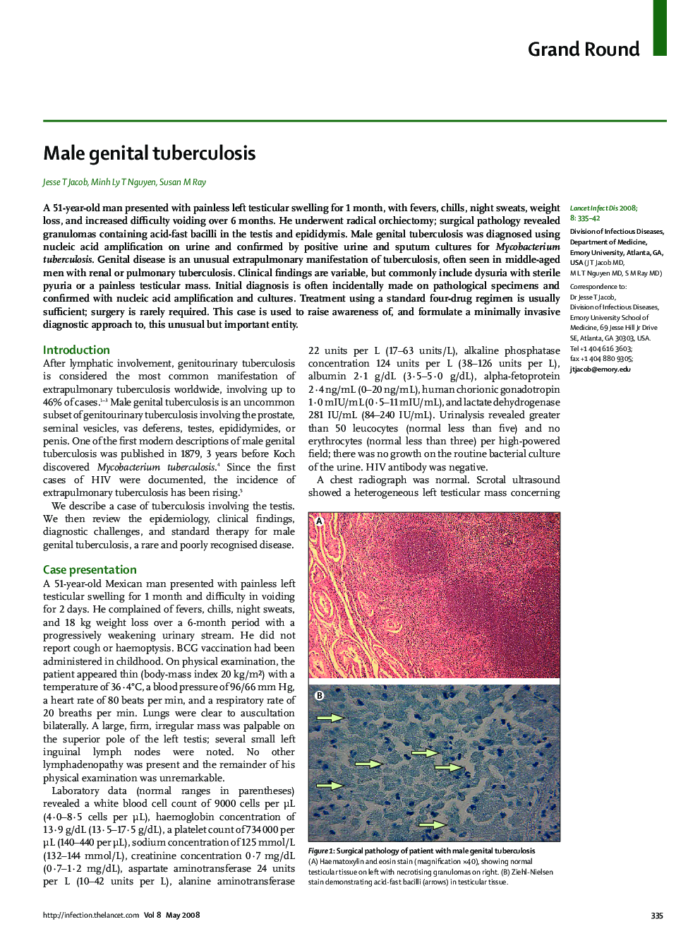 Male genital tuberculosis