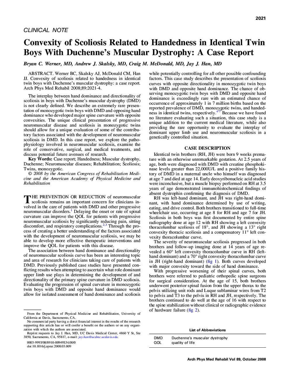 Convexity of Scoliosis Related to Handedness in Identical Twin Boys With Duchenne's Muscular Dystrophy: A Case Report