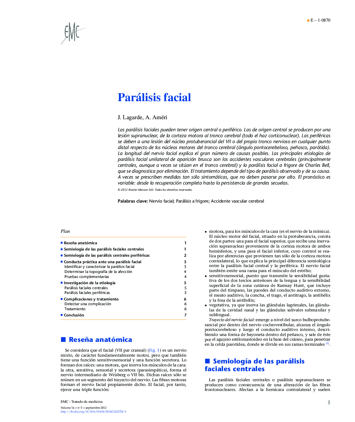 Parálisis facial