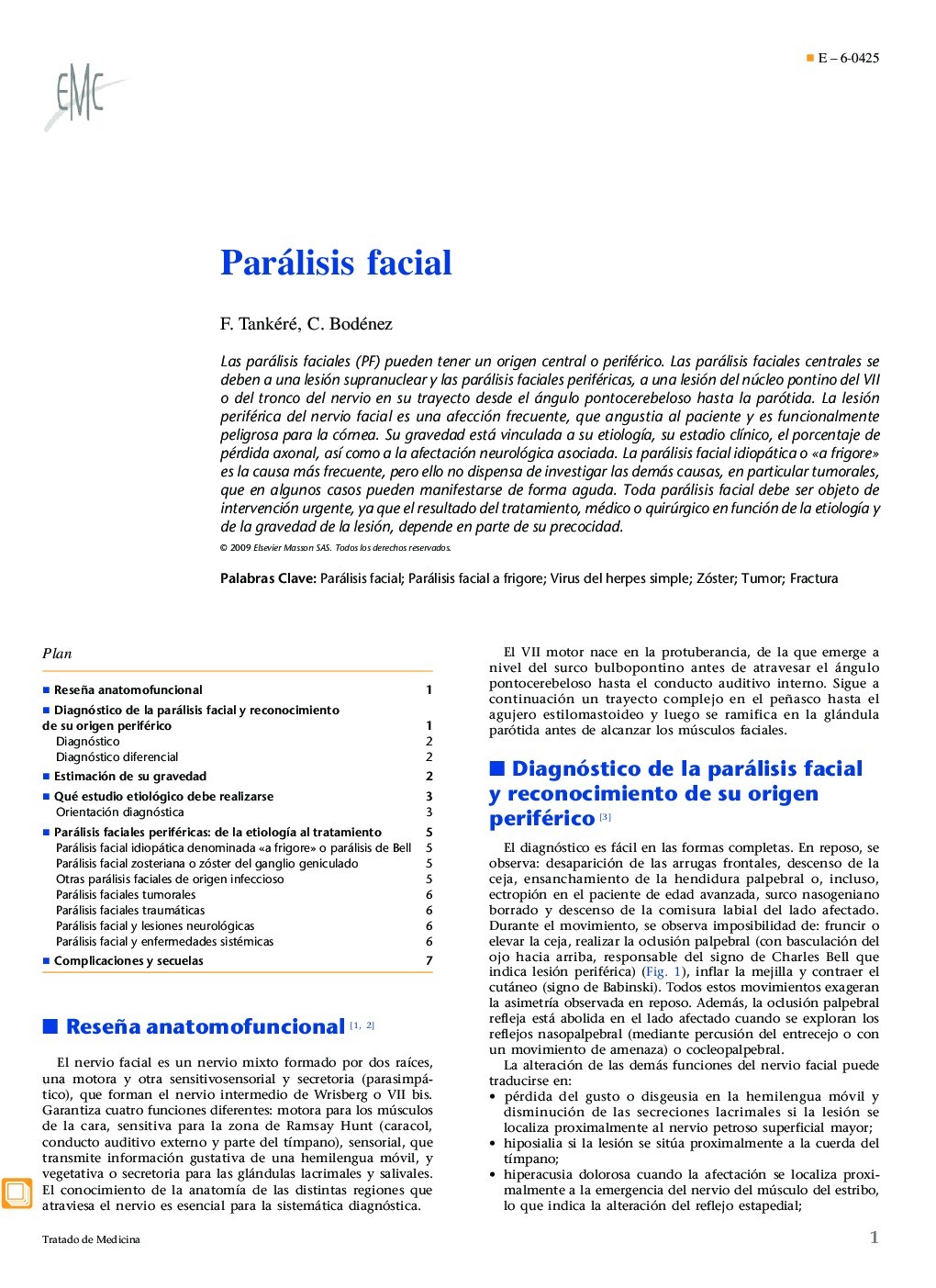 Parálisis facial