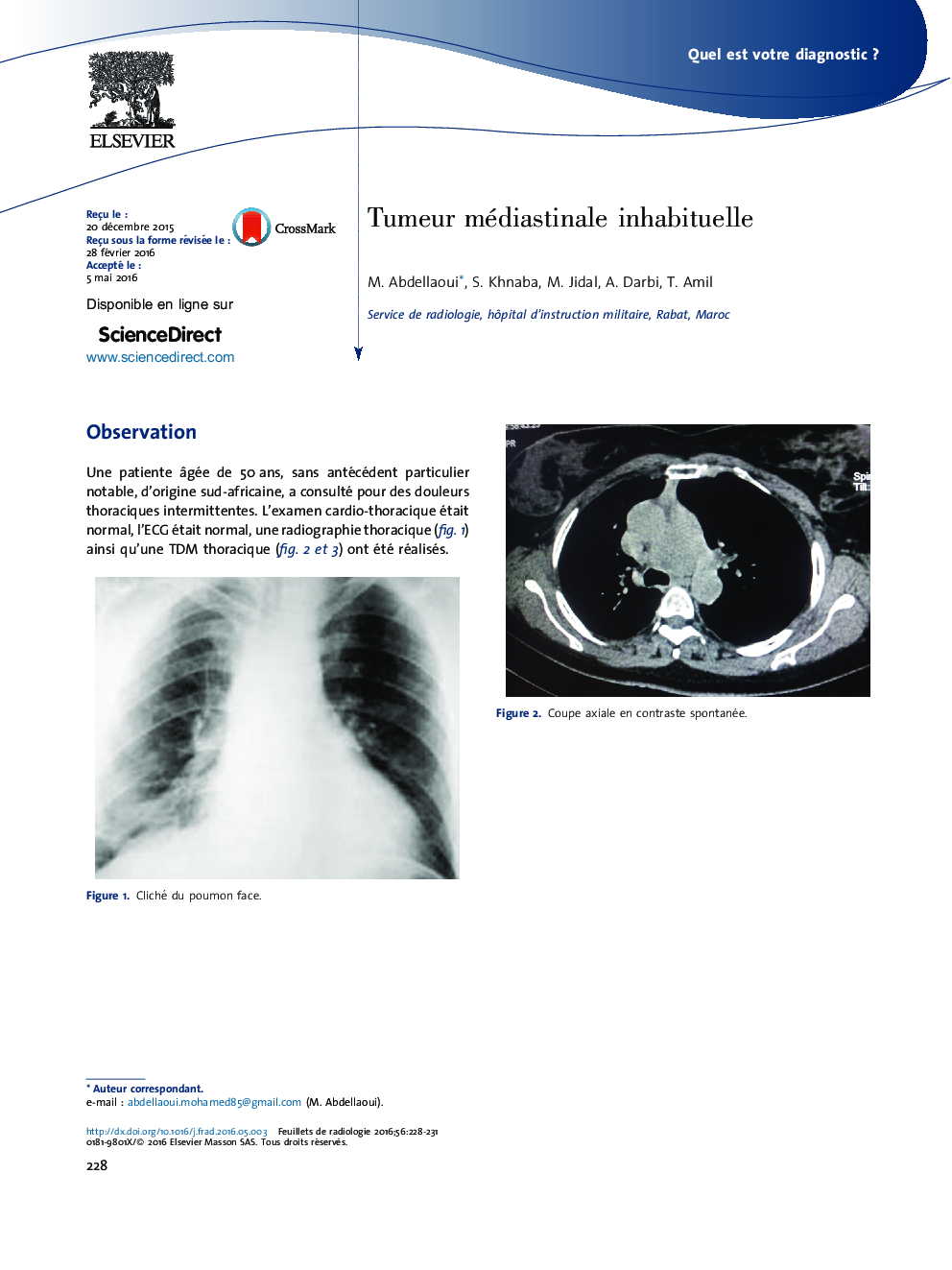 Tumeur médiastinale inhabituelle